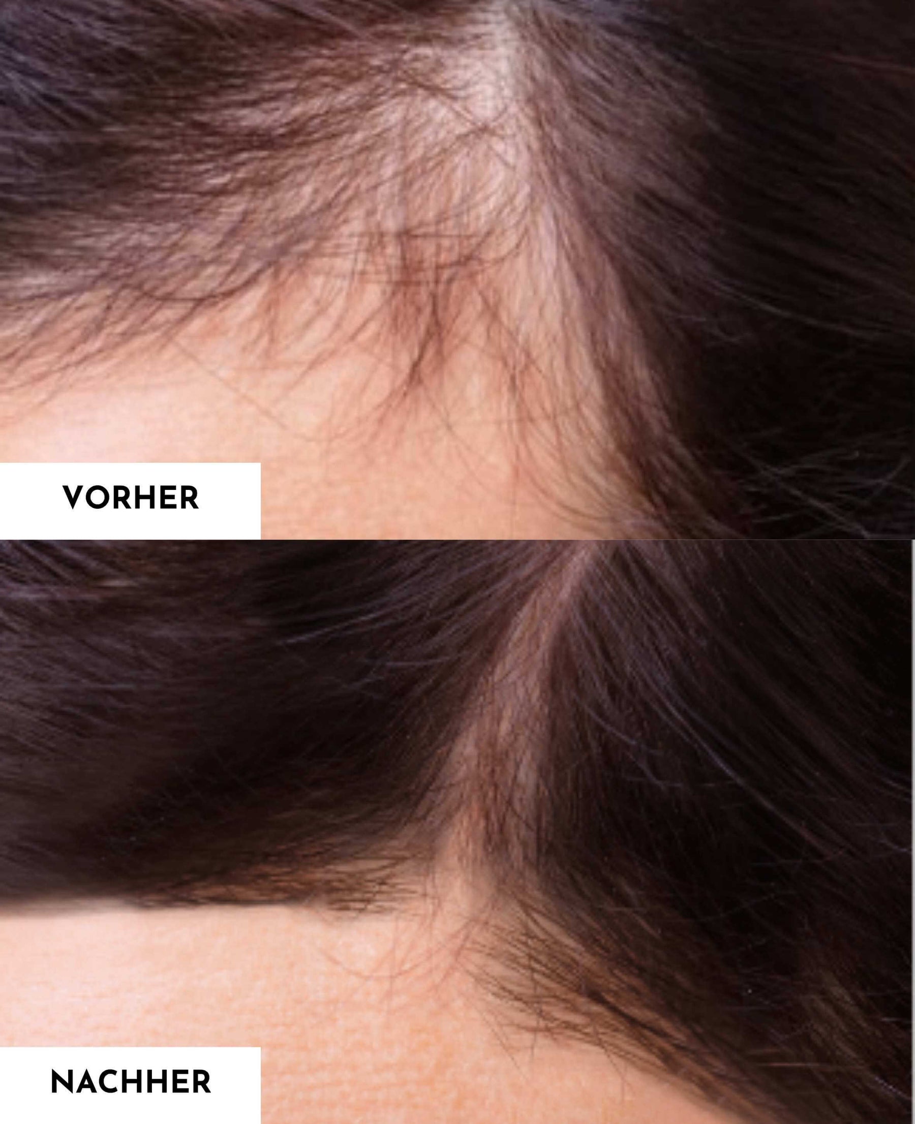hair serum